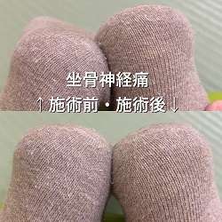 和泉市 椎間板ヘルニア根本改善整体 笑福整骨院【木を見て森を治す】